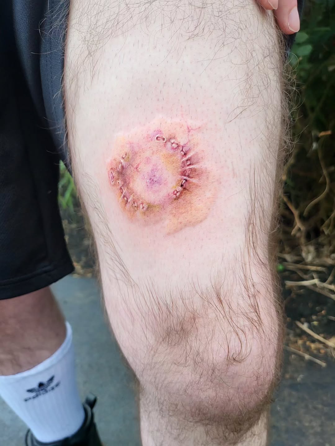 Tattoo by @broken.teeth.tattoos — realism, dark_realism